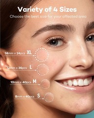 Professional Hydrocolloid Acne Patches – 4 Sizes, 140 Count, Safe for All Skin