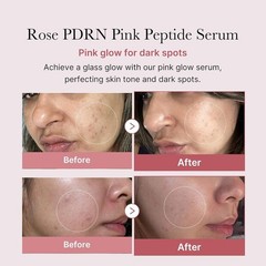 ‘Medicube PDRN Pink Peptide Serum–SALMON DNA For Anti-Aging Care 30ml/1.01 fl oz