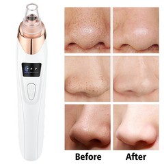 Electric Blackhead Remover Pore Nose Sucker Pimple Skin Acne Face Cleaner Vacuum