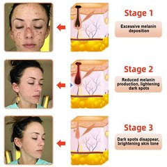 Exfoliating Purifying Gel, Quarxery Purifying Cream for Face & Body 50g