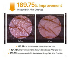 Dr. Melaxin Peel Shot Exfoliant Kojic Acid Turmeric Spray 200ml Brand new**