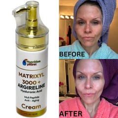 Dark Skin Whitening Dark spot Brightening Bleaching Lightening Face body Cream.