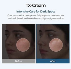 DR. Melaxin TX-Cream | Tranexamic Acid | Niacinamide 50ml-+