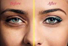 Under Eye Wrinkle Cream Gel – Remove Dark Circles Crows Feet Bags Lift Firm