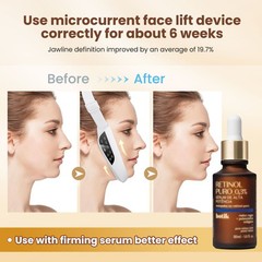 V-Face Electric Facial Lifting Device Double Chin Reducer Face Slimming Massager