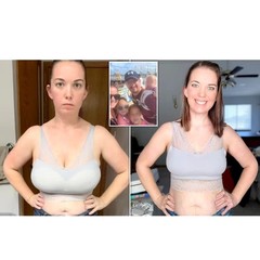 Breast Reduction Serum 10ML For Reducing Breast Size To Small, Firming & Lifting