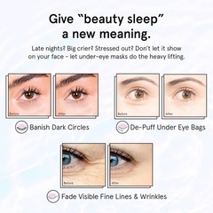 grace & stella Retinol Under Eye Patches for Puffy Eyes & Dark Circles – Restori