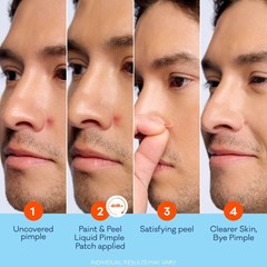 Biore Paint & Peel Liquid Pimple Patch, Invisible 0.5 Ounce (15ml), Clear