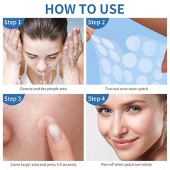 Natural Hydrocolloid Pimple Patches – 4 Sizes for All Skin Types (300 Count)