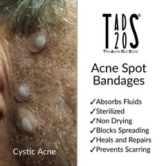 LARGE SURFACE STRIPS, Acne Strips, Rectangular Pimple Patches, FACE SPOT STICKER