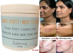 Dark spot cream corrector face acne Made in USa body age spot hands neck 4 fl oz
