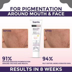 Sanfe Dark Spot Remover for Face Dark Spot Corrector Glow cream Skin Care 20 g