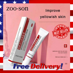 Effective Whitening Freckle Cream Remove Dark Spot Cream Removal Melanin Melasma