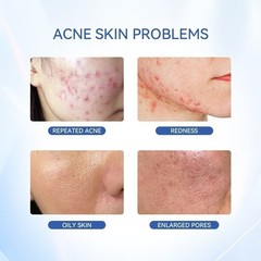 Dr.Leo Acne Essence Salicylic Acid Anti-acne Serum Lighten Acne Scars acne NEW
