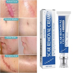 Scar and Acne Mark Removal Gel Ointment Remove Scars Burns Stretch Marks