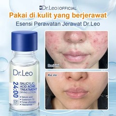 fresh Dr.Leo Acne Essence Salicylic Acid Anti-acne formula Lighten Acne Scars ac