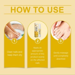 Bee Venom Nail Care Pen Brightening Thickening Moisturizing Repair 4ml”