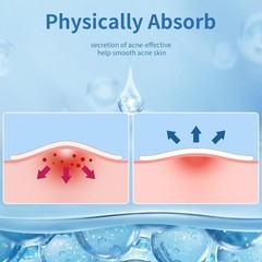Natural Hydrocolloid Pimple Patches – 4 Sizes for All Skin Types (300 Count)